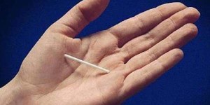 Implan, Pilihan Kontrasepsi Jangka Panjang